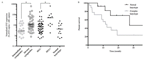 Fig. 1) EVI1 expression in diagnosis 2) Overall survival according to cytogenetic.