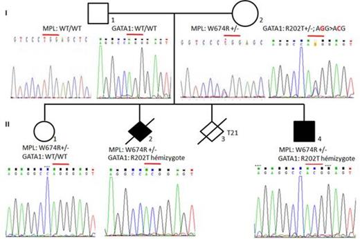 Figure 1:. family pedigree and GATA-1 / MPL genotype
