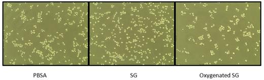Fig. 1. SG Treatment of Sickled RBC. Hypoxic SCD RBC treated with SG, oxygenated SG or PBSA for 2 hrs prior to fixation and image capture (40X mag).