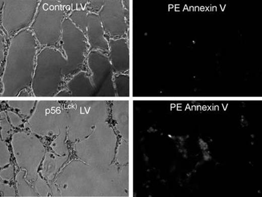 Figure:. Effect of control or p56Lck-expressing lentiviral transduction on endothelial cell tube formation and induction of apoptosis.
