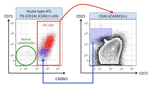 Figure 1. Flow cytometric gating of ATL cells and CD71-CD25+CD4+CADM1+ cells