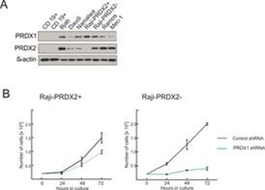 Fig. 1. (A) Protein level of PRDX1 and PRDX2 in a panel of Burkitt's lymphoma (Bjab, Daudi, Namalwa, Raji, Ramos) and B-CLL (Mec1) cell lines as compared to normal B cells isolated from healthy donors using magnetic beads (CD19 positive selection, EasySep). (B) Effects of PRDX1 downregulation by shRNA on proliferation and survival of Raji cells. Raji cells, which do express PRDX2 (Raji-PRDX2+) and the subclone of Raji cells which do not express PRDX2 (Raji-PRDX2-), were transduced with lentiviruses encoding PRDX1-specific shRNA and control, non-targeting shRNA and subjected to selection with puromycin. The number of viable cells was evaluated 24, 48, and 72 hours post selection.
