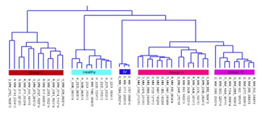 Figure:. Subgrouping of MM patient samples (I-IV) based on selective drug response profiles. H/D/R denotes healthy, diagnostic and relapse, respectively.