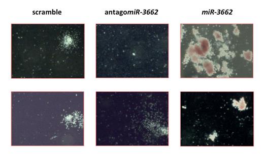 Figure 1. Effect of miR-3662 overexpression and knock-down on colony formation of HPCs.