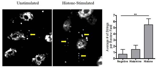 Figure 1. Representative images taken after flow experiment. Arrows indicate VWF-platelet strings. Graph is expressed in mean ± SD (**p=0.0025).