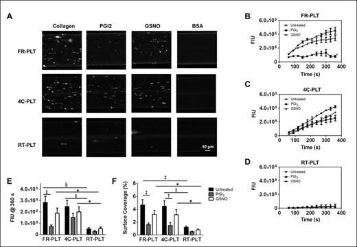 Figure 1. Platelet adhesion under high shear with and without inhibitors. (A) Micrographs of FR-PLT, 4C-PLT, and RT-PLT samples are shown for a single donor after 6 minutes of perfusion. Representative fluorescence intensity unit (FIU) traces are shown for (B) FR-PLT, (C) 4C-PLT, and (D) RT-PLT (Untreated •, PGI2 ■, and GSNO ▲). Data for (E) FIU (n=4) and (F) SC% (n=4) after 360 s are mean ± SEM (Untreated = black, PGI2= gray, and GSNO = white). The micrographs were cropped and enlarged; however image size proportionality was maintained between groups and timepoints. * p<0.05, † p<0.01, and ‡ p<0.001, and § p<0.0001