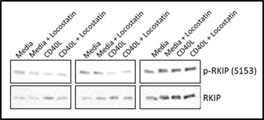 Figure 1. RKIP is phosphorylated on S153 in CLL patient samples.