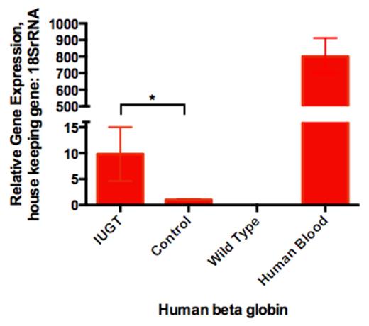 Figure A. Quantification of human beta globin mRNA using qPCR (*p<0.01)