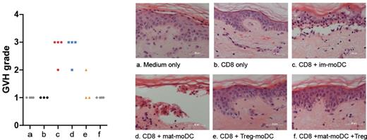 Figure 1. Skin histopathology induced by CD8 T cells primed with im-DC, mat-DC and Treg-DC