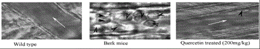 Figure 1:. Representative images showing postcapillary venules in the cremaster muscle microcirculation of Berk mice compared to QUE treated and wild type. Black arrows indicate leukocytes and white arrows indicate the blood flow direction.