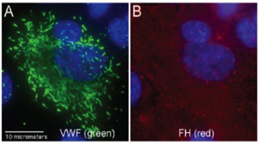Fig 1. Immunofluorescent images of HUVECs stained for VWF and FH.