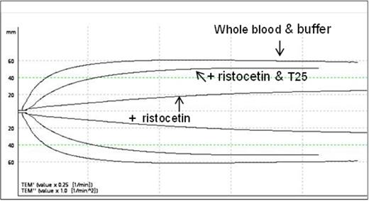 Figure 1. VWF Aptamer T25 Restores the Decrease in Clot Strength by Ristocetin in Citrated Whole Blood from a Normal Donor.