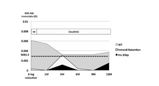 Figure 2. Transition of AS BCR-ABL transcript variant in case who achieved MR3.0 but not MR4.5 under TKIs treatment for more than 1-year.