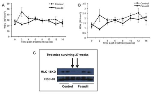 Figure:. Fasudil activity in mouse model of Cbl/Cbl-b DKO MPD. Total WBC (A) and monocyte (B) counts over time in untreated and fasudil-treated mice (mean+/-SEM), C: MLC levels by Western Blot in peripheral blood of control vs. fasudil-treated mice; those surviving longer than 27 weeks are indicated.