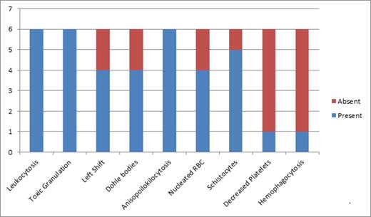 Figure 1:. Peripheral Smear Findings of Systemic Loxoscelism
