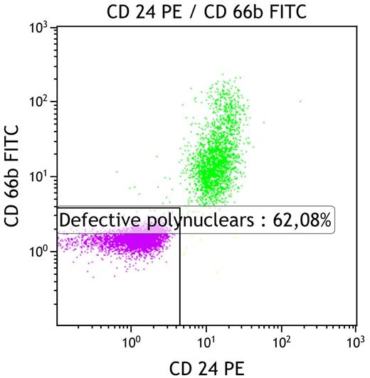 Figure 2. Bone Marrow