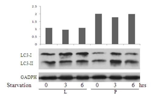 Figure 1. LAPTM5 gene suppressed K562 cells' autophagy activity. K562 cells transfected with LAPTM5(L) and empty vector (P) were cultured in HBSS conditional media for 6 hrs. On the time point of 0hrs, 3hrs and 6hrs, transfected cells were collected and run Westernblot with the antibody of LC3-II and LC3-I. The ratio of LC3-II/LC3I which represented the extent of autophagy activity decreased in K562/LAPTM5 (L).