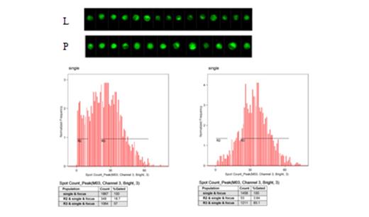 Figure 2. Autophagy activity of K562 transfectants were detected by Flow. K562 cells transfected with LAPTM5(L) had less fluorescent spots than that of K562 transfected with empty vector (P).