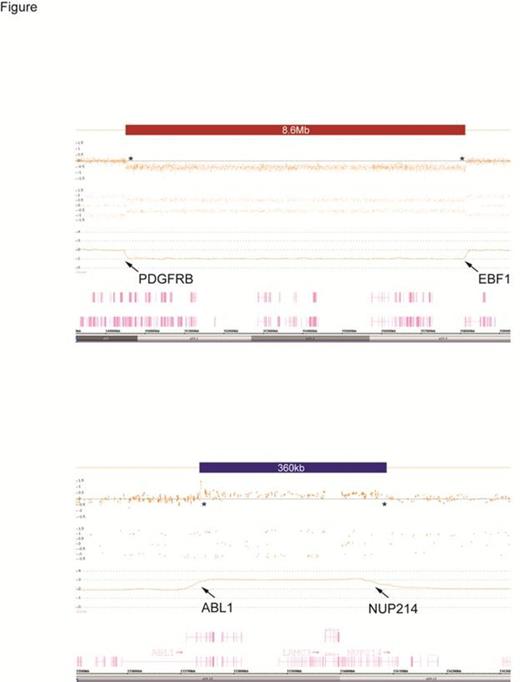 Figure 1. Figure Legend: CMA results for patients 1 and 2. Top panel: Array plot showing the 8.6Mb 5q32-q33.3 deletion (red bar) in patient 1, that fuses exon 11 of the EBF1 gene with exon 15 of PDGFRB. Bottom panel: The 360kb duplication at 9q34 (blue bar) in patient 2, with the breakpoints within the ABL1 gene and the NUP214 gene, resulting in the NUP214-ABL1 fusion.