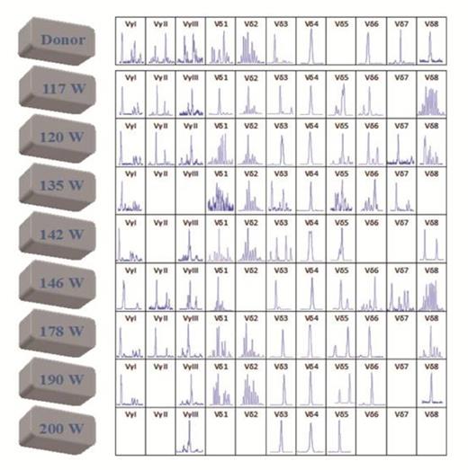 Figure 1. The CDR3 spectratyping of the TCR Vγ and Vδ subfamily T cells in peripheral blood from donor and recipient at different time points after allo-HSCT.