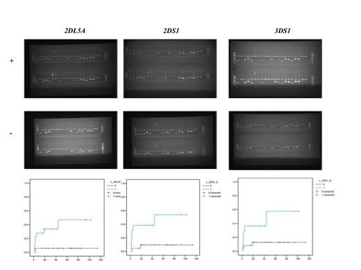 Figure 1. Donor KIR genotyping (2DL5A, 2DS1 and 3DS1) impacts in overall survival.