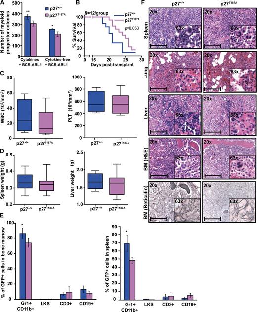 Figure 4. Stabilization of p27 in the nucleus attenuates BCR-ABL1–induced leukemia. (A) BM cells from p27+/+ and p27T187A mice were transduced with BCR-ABL1 retrovirus, sorted by FACS for GFP+/Lin− cells, and plated in methylcellulose in the presence or absence of cytokines. Myeloid colony formation of BCR-ABL1–transduced cells was assessed after 8 days. (B) p27+/+ mice were transplanted with BCR-ABL1–transduced BM cells from p27+/+ and p27T187A mice and survival was analyzed using Kaplan-Meier statistics. (C) WBC and PLT counts and (D) spleen and liver weights of leukemic mice were compared according to genotype. (E) Lineage distributions of GFP+ cells in the bone marrow and spleen of leukemic mice: granulocytes (Gr1+CD11b+), B cells (CD19+), T cells (CD3+), and LKS cells (Lin−c-Kit+Sca1+). Error bars represent standard deviation. (F) Representative histological sections of BM, liver, lung, and spleen from mice transplanted with BCR-ABL1–transduced BM cells from p27+/+ and p27T187A mice. Scale bars represent 100 μm. In the above experiments, *P < .050, **P < .010. PLT, platelet.