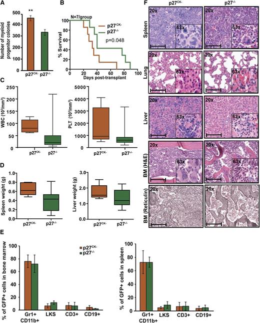 Figure 6. Cytoplasmic p27 promotes BCR-ABL1–induced leukemia. (A) BM cells from p27−/− and p27CK− mice were transduced with BCR-ABL1 retrovirus, sorted by FACS for GFP+/Lin− cells and plated in methylcellulose in absence of cytokines. Myeloid colony formation of BCR-ABL1–transduced cells was assessed after 8 days. (B) Kaplan-Meier survival analysis of p27+/+ mice transplanted with BCR-ABL1–transduced BM cells from p27−/− and p27CK− mice. (C) WBC and PLT counts and (D) spleen and liver weights of leukemic mice were compared according to genotype. (E) Lineage distributions of GFP+ cells in the BM and spleen of leukemic mice: granulocytes (Gr1+CD11b+), B cells (CD19+), T cells (CD3+), and LKS cells (Lin−c-Kit+Sca1+). Error bars represent standard deviation. (F) Representative histological sections of BM, liver, lung, and spleen from mice transplanted with BCR-ABL1–transduced BM cells from p27−/− and p27CK− mice. Scale bars represent 100 μm. In above experiments, **P < .010.