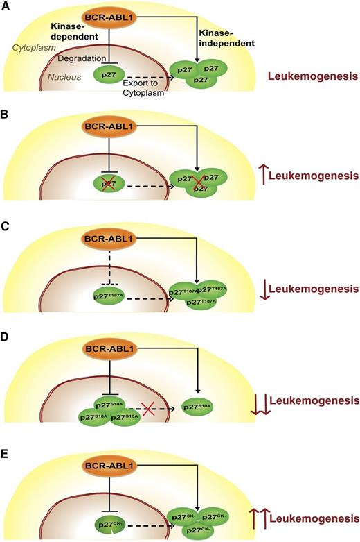 Figure 7. Schematic describing the function of p27 in CML. (A) p27 distribution in CML cells. BCR-ABL1 degrades nuclear p27 in a kinase-dependent manner and promotes its cytoplasmic localization in a kinase-independent manner. (B) Complete loss of p27 (p27-null mutant). The absence of p27 promotes leukemogenesis, consistent with a net tumor-suppressive function of p27. (C) Nuclear stabilization of p27 (p27T187A mutant). Stabilization of nuclear p27 as a result of the p27T187A mutation only moderately attenuates leukemia because the oncogenic effect of cytoplasmic p27 persists. (D) Decreased p27 export to the cytoplasm (p27S10A mutant). Reduced cytoplasmic p27 and increased nuclear p27 retention due to the p27S10A mutation significantly reduces leukemogenesis of p27S10A mice. (E) Functional cytoplasmic and nonfunctional nuclear p27 (p27CK− mutant). The presence of functional cytoplasmic p27 and the complete absence of functional nuclear p27 in leukemic cells as a result of the p27CK− mutation promote leukemogenesis. As we do not provide direct evidence for trafficking of nuclear p27 to the cytoplasm, a dashed line was used to suggest nuclear-cytoplasmic shuttling of p27.