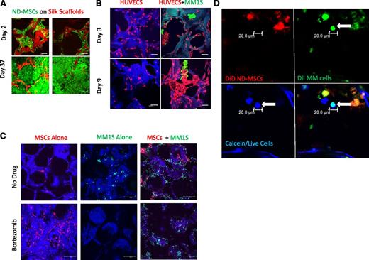 Figure 1. Development of an in vitro 3D BM niche model. (A) Confocal images of calcein-labeled ND-MSCs, passage 2, (calcein/live cells, green; silk scaffold, red) at 2 and 37 days of culture in osteogenic media. The scale bar represents 100 μm. (B) Confocal images of RFP+HUVECs (red) ± GFP+MM1S cells (green) on scaffolds (blue) (days 3 and 9; scale bar = 100 μm). Representative image of 3 experiments is shown here, cultured in endothelial growth media. (C) Confocal images at day 30 of culture of GFP+MM1S alone (left, green), DiD-labeled MSCs alone (middle, red), and cocultures (right) in 50-50 medium with bortezomib (top, 5 nM) or without bortezomib (bottom) on autofluorescent scaffolds (blue). (Scale bar = 100 μm.) (D) Confocal images of primary patient CD138+ MM cells (green with DiI) at day 7 seeded onto ND-MSCs (red with DiD). Channels show the myeloma cell (arrow) as alive (calcein+, blue), DiI+ (green), and DiD– (red). Overlay of green and blue appears cyan and demonstrates colocalization of calcein and DiI staining. Samples cultured in 50-50 media (n = 3); the scale bar represents 20 μm.