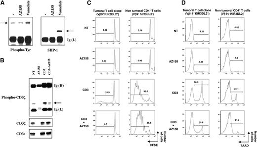 Figure 1. KIR3DL2 inhibitory function on SS patients’ malignant T-cell clone. (A) Sorted CD4+ T cells from SS patients were left untreated (−) or incubated with anti-KIR3DL2 monoclonal antibody (mAb) AZ158 plus goat anti-mouse IgG antibodies or with the phosphatase inhibitor vanadate. Cell lysates were prepared and subjected to immunoprecipitation using the anti-KIR3DL2 mAb AZ158. The immunoprecipitates were separated by SDS-8% PAGE, transferred onto a nitrocellulose membrane, and then probed in series with anti-phosphotyrosine (Tyr) and anti-SHP-1 antibodies. Arrows indicate the position of phosphorylated KIR3DL2 and SHP-1. Results shown (patient 2) are representative of all patients tested (n = 3). (B) Sorted CD4+ T-cells from SS patients were incubated with anti-CD3ε or/and AZ158 mAb, as indicated. An isotype-matched control mAb was used to equalize the amount of antibodies used in each condition. Cross-linking was induced by the addition of goat anti-mouse Igs except for resting condition (NT). After lysis, the antibody-targeted molecules were collected and the resulting immunoprecipitates subjected to electrophoresis and western blotting procedures. The immunoblot was revealed with an anti-phospho-CD3ζ mAb (upper panel) and was reprobed after dehybridization using an anti-CD3ζ mAb (middle panel). CD3ε immunoblotting was performed to assess efficient cell targeting and immunoprecipitation (lower panel). Arrow indicates the position of phospho-CD3ζ. Results shown (patient 3) are representative of all patients tested (n = 3). (C) Peripheral blood mononuclear cells from SS patients were preloaded with carboxyfluorescein diacetate succinimidyl ester (CFSE) and left untreated (NT) or stimulated with platebound anti-CD3ε and AZ158 mAb alone or in combination, as indicated. After 4 days of culture, cells were collected and immunolabelings performed using anti-TCRVβ-PE, anti-CD3-PE-Cy5, and anti-CD4-PE-Cy7 mAb. The percentages of dividing cells among the malignant (left) and the nonmalignant (right) CD4+ T-cell populations are presented. Results shown corresponded to patient 3, whose tumoral clone was identified as TCR-Vβ14+, and are representative of experiments performed on 3 SS patients. (D) Peripheral blood mononuclear cells of SS patients were activated as described for panel C for 6 days. After immunostaining with anti-CD3-FITC, -TCRVβ-PE, and -CD4-PE-Cy7 mAbs, and 7-AAD, cells were analyzed by flow cytometry. The percentage of 7-AAD+ apoptotic cells within the malignant (left) and the nonmalignant (right) CD4+ T cells is indicated for each condition of incubation. Results shown (patient 5, with a TCR-Vβ9+ malignant clone) are representative of experiments performed on 3 SS patients. Ig (H) and (L), Ig heavy and light chain; NT, nontreated.