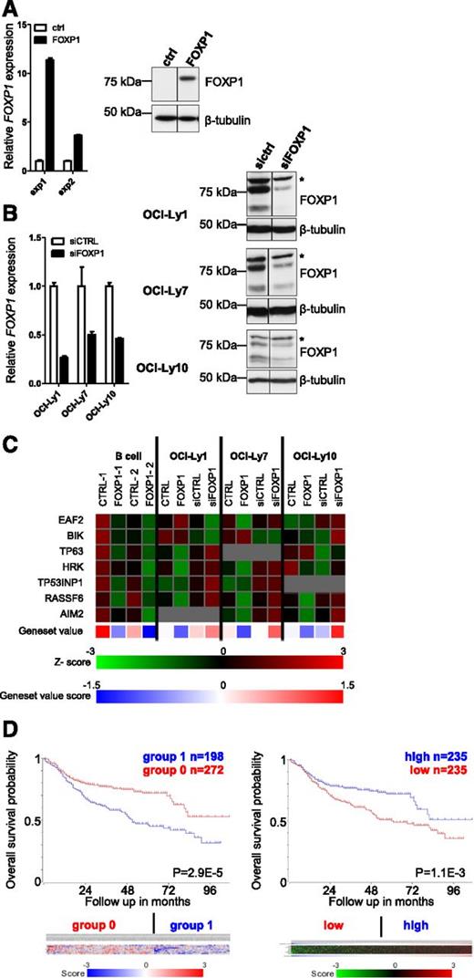 Figure 1. Identification of FOXP1-regulated genes in primary human B cells and DLBCL cell lines by GEM analysis. To identify FOXP1-regulated genes, we conducted GEM analysis upon retroviral overexpression or RNA interference–mediated silencing of FOXP1 in primary B cells and DLBCL cell lines. (A-B) Expression levels of FOXP1 in primary B cells (A) and DLBCL cell lines (B) upon retroviral transduction or siRNA transfection. (A) Human primary B cells were transduced with FOXP1-IRES-YFP or ctrl-IRES-YFP and cultured with CD40L-L cells. (Left) Three days after transduction, YFP-positive fractions were sorted, RNA was isolated, and gene expression levels were analyzed by qRT-PCR. Expression levels were normalized to expression levels in empty vector–transduced cells. (Right) Three days after transduction, cell lysates were harvested and immunoblotted for FOXP1. β-Tubulin was used as a loading control. (B) DLBCL cell lines were transfected with siRNA against FOXP1. (Left) One day after nucleofection, RNA was isolated and gene expression levels were analyzed by qRT-PCR. Expression levels were normalized to expression levels in control siRNA–transduced cells. (Right) Two days after nucleofection with siRNA against FOXP1, cell lysates were harvested and immunoblotted for FOXP1. β-Tubulin was used as a loading control. Asterisk (*) indicates a nonspecific background band. (C) Expression of the proapoptotic genes that were significantly and reproducibly regulated by FOXP1 in microarray analysis of primary B cells and DLBCL cell lines. Data are presented as z-scores calculated within samples of each cell line. The gray squares indicate expression beneath the threshold value (= no expression). The lower panel shows the mean relative expression values of a gene set composed of the 7 proapoptotic genes. (D) Kaplan-Meier plots of the OS of 498 DLBCL patients treated with rituximab-CHOP therapy,37 stratified in 2 groups by expression of the 7 FOXP1-repressed proapoptotic genes. (Left) OS of DLBCL patients stratified in 2 groups by k-means clustering of the 7 genes. The 5-year OS is 72% for the patient group with overall higher (group 0; red) vs 47% in the group with overall lower (group 1; blue) expression of the 7 genes. The color bar displays the z-scores (blue = low, red = high) of each of the 7 proapoptotic genes (from top to bottom): TP63, HRK, EAF2, TP53INP1, AIM2, RASSF6, and BIK. (Right) OS of DLBCL patients stratified in 2 equal-sized groups (separated at the median) by ranking the patients according to their mean z-score of the gene set. The 5-year OS is 72% in the high-expressing (blue) vs 49% in the low-expressing (red) group. The heatmap displays the z-scores (green = low, red = high) of each of the 7 proapoptotic genes (from top to bottom): TP63, RASSF6, BIK, HRK, EAF2, TP53INP1, and AIM. The blue-red bar displays the mean z-scores (blue is low; red is high) for the gene set, according to which the patients were ranked.