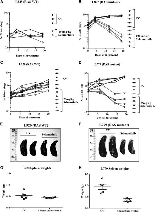 Figure 4. Selumetinib is active in Ras pathway–mutated ALL cells in an orthotopic primagraft model. Graphs showing log of the percent circulating leukemic cells in mice implanted with RAS WT (A,C) or Ras pathway mutant patient blasts (B,D). Mice were treated with either CV or selumetinib twice daily (100 mg/kg for B and 25 mg/kg for D) and the percent of circulating blasts quantified by flow cytometry during and at the end of treatment. Photographs of spleens (E,F) and graphs of spleen weights (G,H) after 30 drug doses of selumetinib in WT primagrafts (E,G) and RAS mutant primagrafts are shown (F,H).