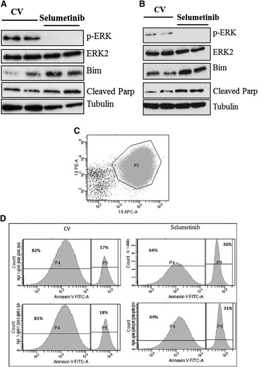Figure 6. Pharmacodynamic analyses after selumetinib dosing in vivo shows prolonged inhibition of p-ERK and induction of apoptosis. Western analyses of spleen cells from mice engrafted with Ras pathway mutant ALL cells after 72 hours of 100 mg/kg (A, L897, KRAS) or 25 mg/kg BID (B, L779, NRAS). Flow cytometric analyses of the spleen harvests from L897 primagrafts stained with antibodies to mouse CD45, human CD19, CD10, and CD34, along with annexin V. Dot plot showing CD10 and CD19 expression of cells gated as lymphoid by light scatter and then for mouse CD45 negativity (C). CD10+CD19+ cells are then gated and displayed as histograms showing annexin-V fluorescence (D).