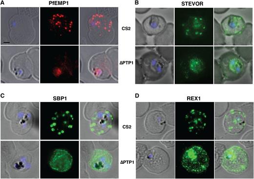 Figure 3. Immunofluorescence assays. (A-D) Immunofluorescence assay on CS2 (top panels) vs CS2ΔPTP1 parasites (bottom panels). Immunofluorescence assay probed with α-PfEMP1 antibody (A), α-STEVOR antibody (B), α-SBP 1 antibody (C), and α-REX 1 antibody (D). Scale bar: 1 μm; same size of ROI in each image.
