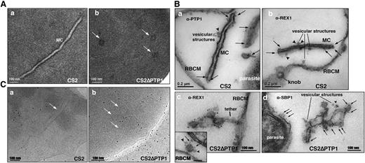 Figure 4. Comparison of transmission electron microscopic studies on CS2 vs CS2ΔPTP1 cell line. (A) Conventional chemical fixation: (a) CS2 parental line. MC (MC) display electron dense membranes and an electron lucent lumen; (b) CS2ΔPTP1 cell line shows globular structures and no long lamellar MC structures (arrows). (B) Equinatoxin II-treated cells with pre-embedding labeling: (a) α-PfPTP1 antibodies or (b) α-REX1 antibodies label the slender MC membranes (arrows) and vesicles (arrowheads) in the CS2 parasite line; (c) α-REX1 or (d) α-SBP1 antibodies label globular structures (arrows) and vesicular structures (arrowheads) in the CS2ΔPTP1 cell line. RBCM, red blood cell membrane. (C) The frozen hydrated samples show MC (arrow) in which the lumen looks similar to the RBC cytoplasm as described earlier.61 The CS2ΔPTP1 cell line shows aggregated globular structures (arrows).