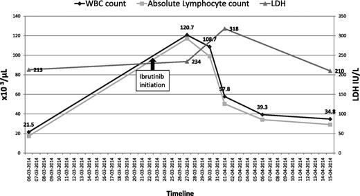 Figure 1. The patient’s total WBC count and corresponding ALC before and after initiation of ibrutinib.
