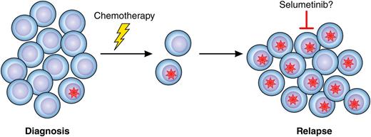 Mutations in the RAS signaling pathway (red star) are frequently present in a small subset of leukemic blast cells at diagnosis of pediatric ALL. Cells harboring the mutation may survive chemotherapy, resulting in relapse, which could be treatable with selumetinib, targeting MEK downstream of RAS signaling. Professional illustration by Patrick Lane, ScEYEnce Studios.