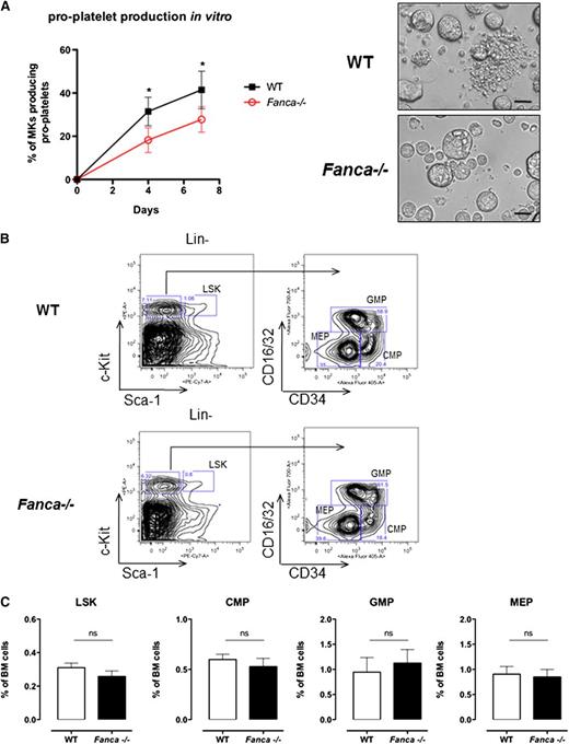 Figure 1. Fanca deficiency affects pro-platelet formation. (A) Pro-platelet production in vitro and representative images presenting CD41+Lin− WT and Fanca−/− cells at day 4 of culture (n = 4 mice per group, 250 alive MKs per point were scored, *P < .05, Student t test; scale bar = 50 μm). (B) Representative flow cytometry plots showing the gating strategy to identify different progenitors. (C) Number of Lin−Sca-1+c-Kit+ (LSK) cells and myeloid progenitors (CMPs, GMPs, and MEPs) in the BM of Fanca−/− and WT mice (n = 5 per group, results presented as means ± SEM; LSK, P = .2605; CMP, P = .4895; GMP, P = .6598; MEP, P = .8014).