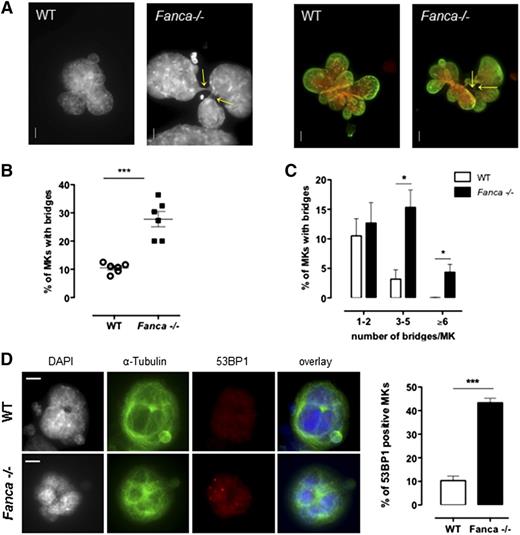 Figure 5. Fanca−/− MKs present high level of nucleoplasmic bridges and DNA damage. (A) Representative view of multilobulated nuclei of WT and Fanca−/− MKs after DAPI (left) and DAPI (red) plus Lamin A/C (green) staining (right; bar = 10 μm). Arrows indicate the location of NPBs. (B,C) Percentages of WT and Fanca−/− MKs with NPBs (B, minimum of 80 cells scored per point, ***P < .001, Student t test) with the indicated number of NPBs per cell (C, n = 3, minimum of 100 cells scored per point, *P < .05, Student t test). (D) Representative images of MKs stained for 53BP1 (left) and percentages of 53BP1-positive MKs (right; n = 3, *P < .05, Student t test, ≥50 cells analyzed per point). Means ± SEM are shown; bar = 10 μm.