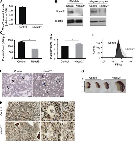 Figure 1. Deficiency of Nbeal2 in mice leads to GPS. (A) Transcript levels of Nbeal2 by qPCR in RNA isolated from in vitro cultured MKs. Results are normalized to levels of GP6 (n = 3). (B) Protein levels of Nbeal2 in platelets and MKs from Nbeal2−/− and control mice. β-actin included as an internal loading control (n = 3). (C) Platelet count in Nbeal2−/− and control animals (n = 13). (D) Mean platelet volume in Nbeal2−/− and control mice (n = 13). (E) Size distribution of the gated platelet population visualized in a representative flow cytometry histogram (forward scatter). (F) Representative May-Grünwald Giemsa stain of blood smears. Arrows indicate the presence of platelets. Platelets are larger and appear gray in Nbeal2−/− samples. Bars represent 20 μm. (G) Different degrees of splenomegaly were observed in Nbeal2−/− mice beyond the age of 9 months. Age-matched control mice were used for comparison (n = 4). (H) A representative reticulin staining of bone sections from mice at 9 months of age showing myelofibrosis in Nbeal2−/− marrow. Bars represent 200 μm. *P < .05.