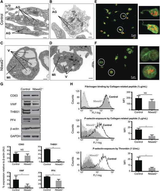 Figure 2. Impaired platelet function in Nbeal2−/− mice. (A-B) Ultrastructure of platelets from control mice showing abundant α-granules (AG), among other organelles. (C-D) Ultrastructure of Nbeal2−/− platelets showing a significant reduction of α-granules, several vacuoles (V) and membrane inclusions (MI). (E-F) Immunolabeling of VWF (red) and CD41 (green) in control (E) and Nbeal2−/− (F) platelets. Images correspond to the maximum intensity projections of an image stack across an entire platelet section. Insets: A higher magnification of the circled platelets is shown for clarification. VWF is restricted to the α-granules in control platelets, whereas its distribution is more diffuse in Nbeal2−/− platelets. Note also the absence of VWF in some Nbeal2−/− platelets. (G) Representative immunoblots of α-granule proteins VWF, THBS1 and PF4 in control and Nbeal2−/− platelet lysates. CD63 (LAMP-3), a lysosomal/dense granule marker, and β-actin and glyceraldehyde-3-phosphate dehydrogenase included as loading controls. Bottom graphs show the densitometry analysis performed using ImageJ (n = 3). *P < .05. (H) Flow cytometry analysis of platelet activation induced by 1 μg/mL collagen-related peptide and 1 U/mL thrombin (n = 4) showing equivalent fibrinogen binding to Nbeal2−/− and control platelets (top panel, only shown for collagen-related peptide) in contrast reduced P-selectin exposure in Nbeal2−/− platelets with both agonists (middle and bottom panels). Plots with vertical lines correspond to basal platelet activation in the absence of agonist. For all graphs, bars represent mean ± standard error of the mean. Scale bars represent 100 nm (A, C) and 500 nm (B, D). *P < .05. NS, nonsignificant; MFI, mean fluorescent intensity.
