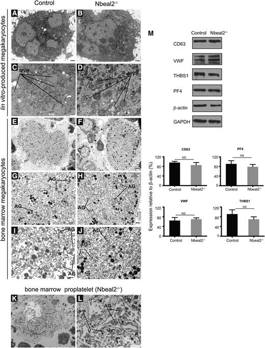Figure 4. Ultrastructure and protein analysis of MKs. (A-D) Ultrastructure of culture-derived MKs from control (A) and Nbeal2−/− (B) mice at low magnification (A-B) and high magnification (C-D), respectively. MVB precursors of α-granules are present in both control and Nbeal2−/− MKs. (E-F) Ultrastructure of bone marrow MKs in control and Nbeal2−/− animals at low magnification. (G-J) Ultrastructure of bone marrow MKs from control and Nbeal2−/− mice at high magnification. A well-defined demarcation membrane system with the presence of platelet territories and α-granules (AG) in control cells (G, I). The demarcation membrane system in Nbeal2−/− MKs is not well-defined (H,J), however, α-granules (AG) are present. (K) Low magnification of a proplatelet-forming MK from Nbeal2−/− bone marrow. (L) High magnification of the circled area in (K) highlights the presence of AG inside the emerging platelet fields, and vacuoles (V) within the MK cytoplasm. (M) Representative immunoblots of α-granule proteins (VWF) (THBS1 and PF4) in control and Nbeal2−/− MKs. CD63 (LAMP-3), a lysosomal/dense granule marker, and β-actin and glyceraldehyde-3-phosphate dehydrogenase included as loading controls. Below, graphs show the densitometry analysis performed using ImageJ (n = 3). Bars represent mean ± standard error of the mean. NS, nonsignificant. Bar represents 2 μm (A-B,E-F,K) and 500 nm (C-D,G-J,L). Representative images were selected from 5 different mice per group.