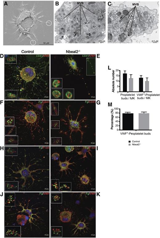 Figure 5. Analysis of α-granules and their content in proplatelet-forming MKs by electron and confocal microscopy. (A) Low magnification of a representative control proplatelet-forming MK by scanning electron microscopy showing proplatelet-like territories emerging from the main core of the cell. (B-C). Higher magnification of the circled areas in (A) seen by TEM. The developing proplatelets contain MVBs, precursors of α-granules. (D-E) Immunolabeling of CD41 and VWF in proplatelet-forming MKs by confocal microscopy in control (D) and Nbeal2−/− (E) cells. VWF is restricted to the MVBs bodies observed in (B-C). The inset at the top-right corner in (E) highlights the presence of a thin MK filament bridging several emerging platelet-like particles. (F-G) Immunolabeling of CD41 in proplatelet-forming MKs previously cultured in the presence of fluorescein isothiocyanate (FITC)-fibrinogen. Fibrinogen is endocytosed and packaged into α-granules in control (F) and Nbeal2−/− (G) MKs, and transported through the proplatelet shafts. (H-I) Proplatelet-forming MKs cultured with FITC fibrinogen, as stated in (F), and P-selectin-immunolabeled in control (H) and Nbeal2−/− (I) samples. (J-K) Proplatelet-forming MKs cultured in the presence of FITC-fibrinogen, as stated in (F), and VWF-immunolabeled in control (J) and Nbeal2−/− (K) samples. (L) Quantitation of proplatelets bud in MK culture. (M) Percentage of proplatelets buds containing the α-granule protein VWF. (D-K) Insets represent a higher magnification of platelet-like particles showing a similar granular distribution of P-selectin, VWF, and fibronogen in control and Nbeal2−/− cells. (D-K) The nucleus was stained with 4,6 diamidino-2-phenylindole (blue). Representative images were selected from 5 different mice per group.