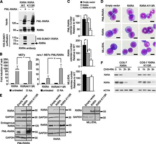 Figure 1. RXRA sumoylation enhances PML/RARA-mediated immortalization. (A) Sumoylation profile of transfected RXRA WT or K113R in H1299 cells stably expressing HIS-SUMO1 and expressing (+) or not (−) PML/RARA. (B) Analysis of rarb gene activation by RA (1 µM) in MEFs expressing RXRA or RXRA K113R in the presence (Rars−/− MEFs, right panel) or absence (MEFs, left panel) of PML/RARA. Error bars represent standard deviations of 3 independent biological replicates. Significance of observed differences was evaluated using Student t test. *P < .05. (C) Progenitors transduced with murine RXRA WT or K113R and PML/RARA, RARA, or MLL-ENL were analyzed for clonogenicity. Error bars represent standard deviations of 3 independent biological replicates. Significance of observed differences was evaluated using Student t test. *P < .05; **P < .01; ***P < .001. (D) Progenitors transduced with murine RXRA WT or K113R and PML/RARA, RARA, or MLL-ENL were analyzed for morphology (bottom bar, 10 µm; MGG stain). (E) Protein expression by western blot (black dividing lines show grouping of images from different parts of the same exposed film). (F) Cos-7 cells coexpressing RARA and RXRA or RXRA K113R were treated with cycloheximide (0.1 mg/mL) and RA (1 µM) for the indicated time, and the half-life of RXRA and RARA proteins was analyzed by western blot.