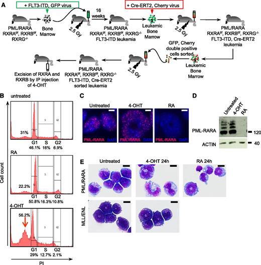 Figure 2. RXR loss induces growth differentiation and apoptosis of PML/RARA-transformed cells. (A) Generation of RXRAf/f RXRBf/f RXRG−/− PML/RARA FLT3-ITD Cre-ERT2 leukemia in mouse model. GFP-sorted spleen cells from leukemic mice were treated with 100 nM 4-OHT or 1 µM RA in culture and analyzed for cell cycle (B), PML/RARA expression (top bar, 10 µm) (C-D), and differentiation (E). RXRAf/f RXRBf/f RXRG−/− MLL/ENL Cre-ERT2 leukemia are shown as negative control (bar, 10 µm; MGG stain). IP, intraperitoneal; PI, propidium iodide.