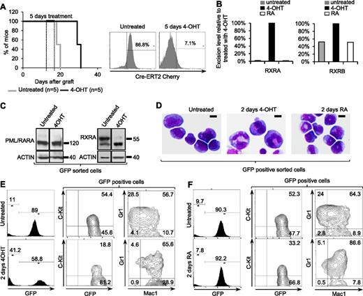 Figure 3. RXR loss induces in vivo differentiation. (A) Left panel: Survival of mice inoculated with APL cells derived from RXRAf/f RXRBf/f RXRG−/− PML/RARA FLT3-ITD Cre-ERT2 mice, untreated or treated with 4-OHT. Right panel: Cherry-positive cells after 5 days of treatment. After 2 days of treatment with 4-OHT or RA in vivo, spleen cells were GFP sorted and analyzed for RXRA and RXRB ablation (B), protein expression (black dividing lines show grouping of images from different parts of the same exposed film) (C), differentiation by MGG staining (top bar, 10 µm) (D), and flow cytometry (E-F).