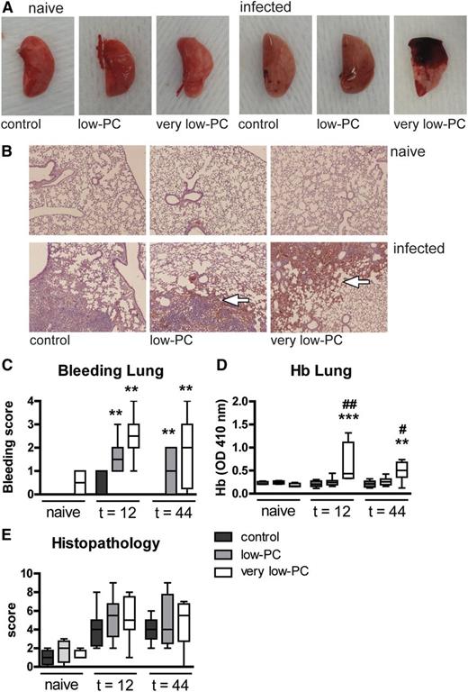 Figure 3. Thrombocytopenia results in PC-dependent lung hemorrhage after infection, with intact hemostasis in distant organs. Very low-PC, low-PC, and control mice were infected with K pneumoniae via the airways and euthanized at 12 or 44 hours. (A) Representative photographs of naive or infected lungs. (B) Representative photomicrographs of H&E-stained tissue sections of naive or infected lungs at 44 hours (original magnification ×4). (C) Lung bleeding was scored on H&E tissue sections by a pathologist blinded for groups. (D) Hb was measured in 50-fold diluted lung homogenates by light density at 410 nm. (E) Severity of inflammation was scored on H&E tissue sections. Data are expressed as box-and-whisker plots depicting the smallest observation, lower quartile, median, upper quartile, and largest observation. n = 8 mice per group. **P < .005 and ***P < .0005 vs control; #P < .05 and ##P < .005 vs low-PC. OD, optical density.