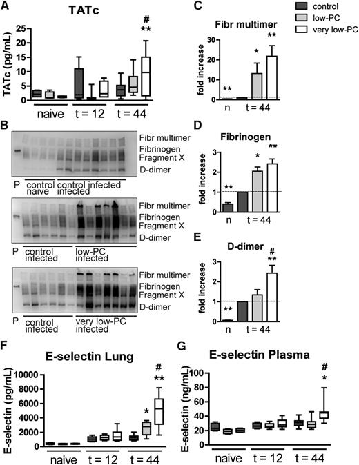 Figure 5. Platelets are not required for coagulation or endothelial cell activation during Klebsiella pneumosepsis. Very low-PC, low-PC, and control mice were infected with K pneumoniae via the airways and euthanized at 12 or 44 hours. (A) Plasma TATc levels were measured as a marker for systemic coagulation activation. (B) Fibrin(ogen) was detected by western blotting on lung homogenate samples. (C-E) Semiquantification of fibrin(ogen) blots; quantification scores of naive control mice, very low-PC, and low-PC mice were normalized to infected controls. E-selectin was measured in lung homogenates (F) and in plasma (G) as a marker for endothelial cell activation. Data are expressed as box-and-whisker plots depicting the smallest observation, lower quartile, median, upper quartile, and largest observation, or as bars depicting mean ± standard error of the mean (SEM). n = 8 mice per group. *P < .05 and **P < .005, vs control; #P < .05 vs low-PC. Fibr, fibrinogen.