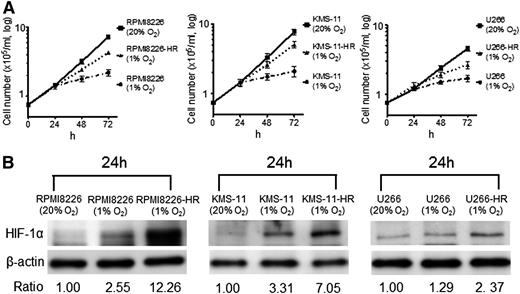 Figure 1. The response of HR-MM cells to hypoxia. (A) The growth of parental cells (RPMI8226, KMS-11, U266) and HR-MM cells (RPMI8226-HR, KMS-11-HR, U266-HR) were measured after 24, 48, and 72 hours of normoxic (20% O2) or hypoxic (1% O2) culture conditions. (B) The expression level of HIF-1α protein in parental cells and HR-MM cells cultured under 20% or 1% O2 conditions for 24 hours. Numbers below the panels represent the normalized HIF-1α expression signal by β-actin (ratio).