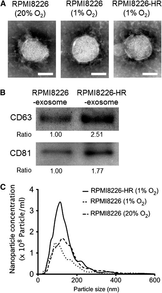 Figure 2. Characterization of exosomes derived from HR-MM cells. (A) Transmission electron micrographs of exosomes derived from parental cells (RPMI8226 cells cultured under 20% or 1% O2 conditions) and HR-MM cells (RPMI8226-HR cells cultured under 1% O2 condition). The scale bar represents 50 nm. (B) CD63 and CD81 (common exosomal markers) immunoblots of exosomes derived from RPMI8226 and RPMI8226-HR cells. These exosomes were isolated from 5 mL of culture media of RPMI8226 (5 × 105 cells/mL) or RPMI8226-HR cells (5 × 105 cells/mL) cultured under 20% O2 or 1% O2 conditions for 24 hours, respectively, and the same amounts of exosome lysate (30 µL) were loaded in each lane of the gels. The ratio of CD63 and CD81 expression is indicated below the panels. (C) The nanoparticle concentration and size distribution of the exosomes derived from RPMI8226 cells cultured under 20% or 1% O2 conditions for 24 hours (dotted lines) and RPMI8226-HR cells cultured under 1% O2 conditions for 24 hours (solid lines).